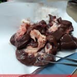 Organet e ekskretimit – Veshkët