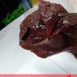 Organet e ekskretimit – Veshkët